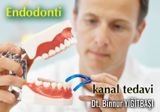 Endodonti kanal tedavi